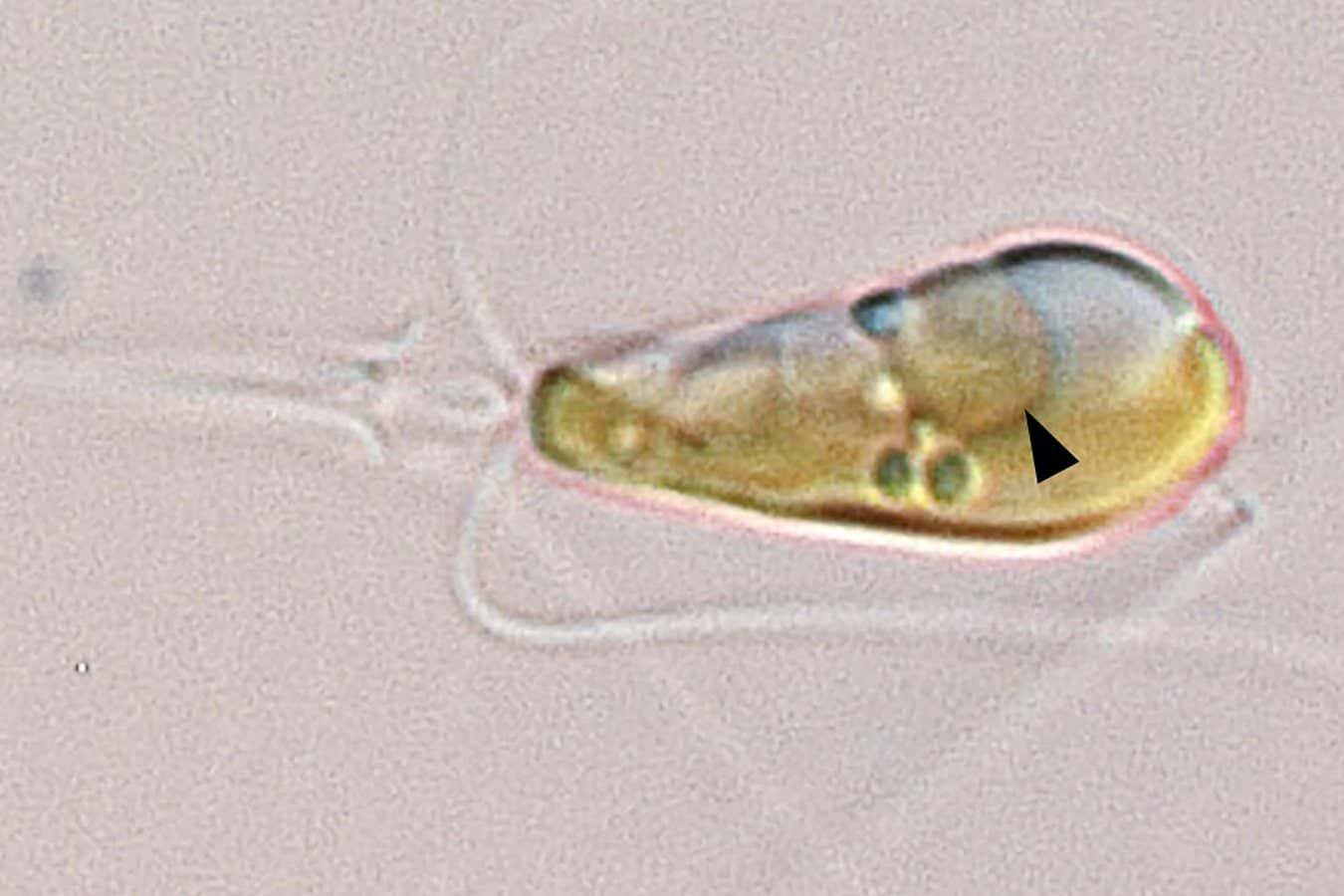 Водоросль Braarudosphaera bigelowii с новообразованным нитропластом (указан чёрной стрелкой)